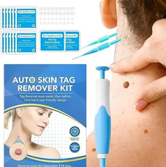 Acrochordon Skin Remover Kit Advibe Studio