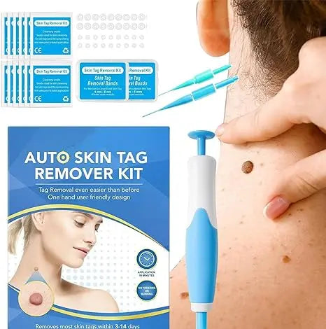 Acrochordon Skin Remover Kit Advibe Studio