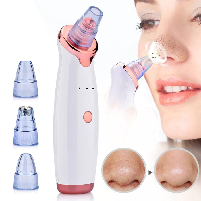 Electric Suction Blackhead Remover